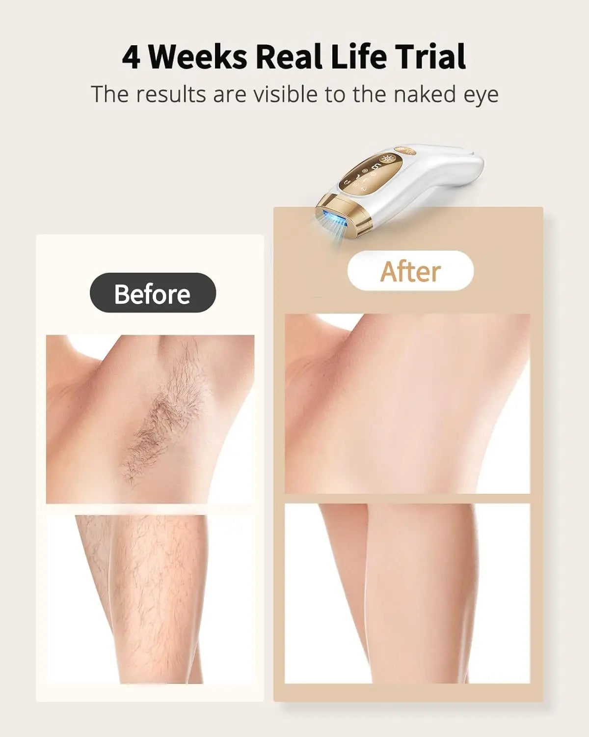 Hair Removal Unlimited Laser Ice-Cooling For Men Women Body Bikinis intimate